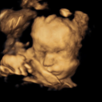 Babylist Registry Photo.