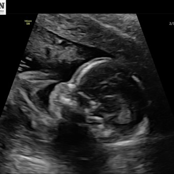 Babylist Registry Photo.
