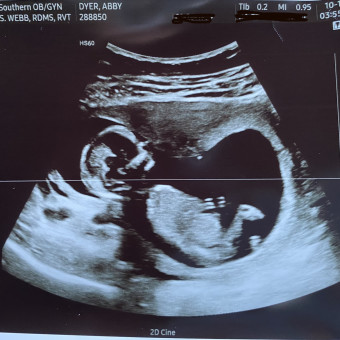 Babylist Registry Photo.