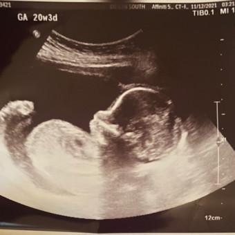 Babylist Registry Photo.