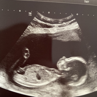 Babylist Registry Photo.