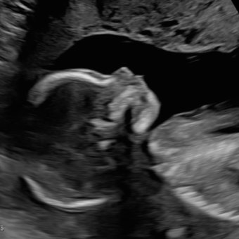 Babylist Registry Photo.
