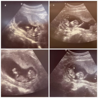 Babylist Registry Photo.