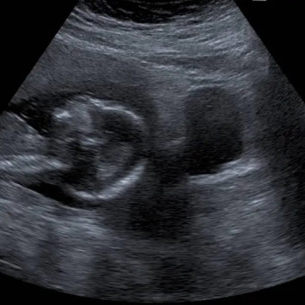 Babylist Registry Photo.