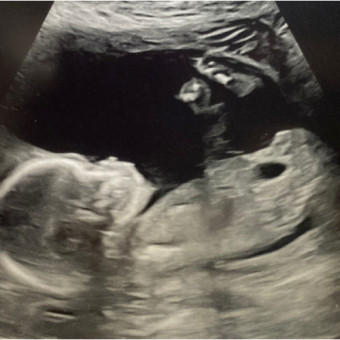 Babylist Registry Photo.