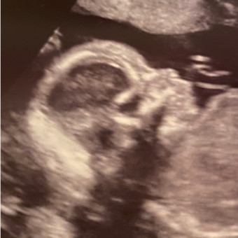 Babylist Registry Photo.