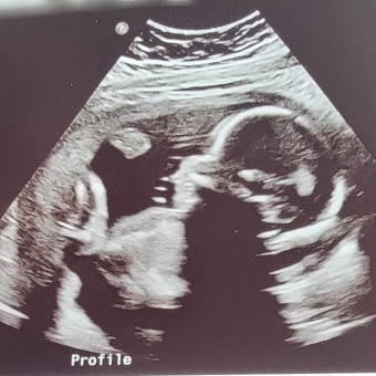 Babylist Registry Photo.