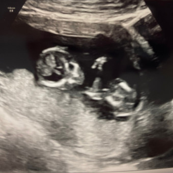 Babylist Registry Photo.