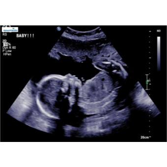 Babylist Registry Photo.