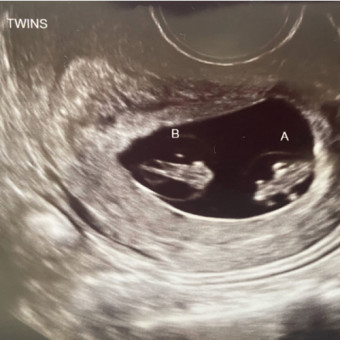 Babylist Registry Photo.