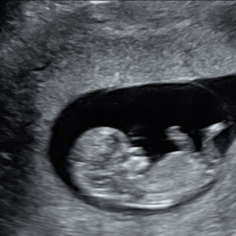 Babylist Registry Photo.