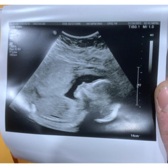 Babylist Registry Photo.