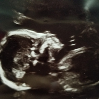 Babylist Registry Photo.