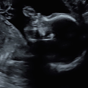 Babylist Registry Photo.