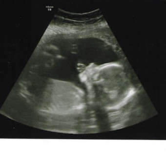 Babylist Registry Photo.