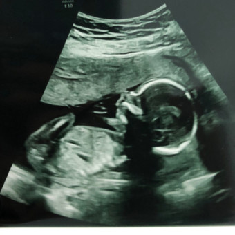 Babylist Registry Photo.