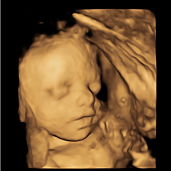 Babylist Registry Photo.