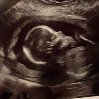 Babylist Registry Photo.