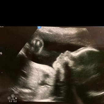 Babylist Registry Photo.