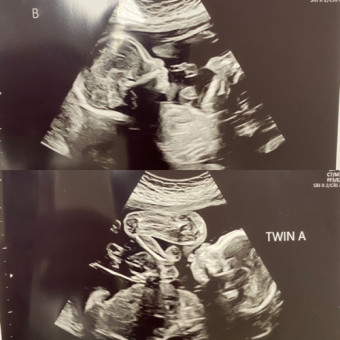 Babylist Registry Photo.