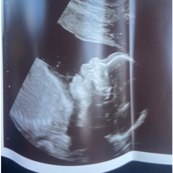 Babylist Registry Photo.