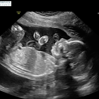 Babylist Registry Photo.