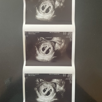 Babylist Registry Photo.