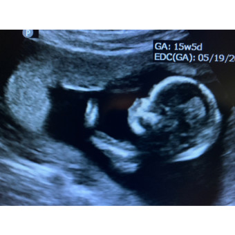Babylist Registry Photo.