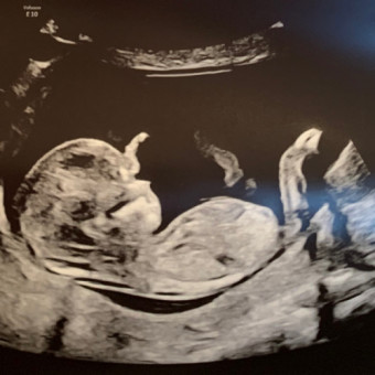 Babylist Registry Photo.