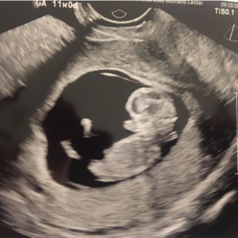 Babylist Registry Photo.