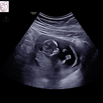 Babylist Registry Photo.