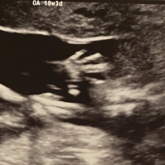 Babylist Registry Photo.