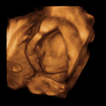 Babylist Registry Photo.