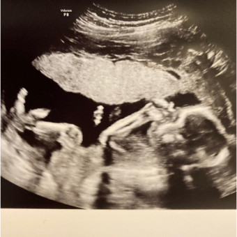 Babylist Registry Photo.