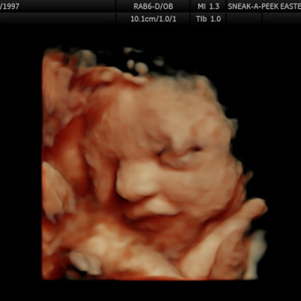 Babylist Registry Photo.