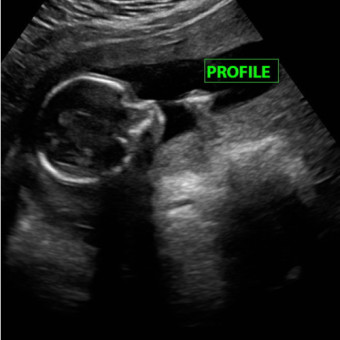 Babylist Registry Photo.