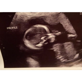 Babylist Registry Photo.