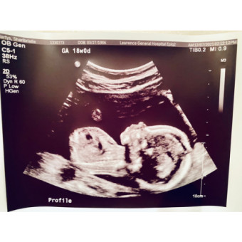 Babylist Registry Photo.