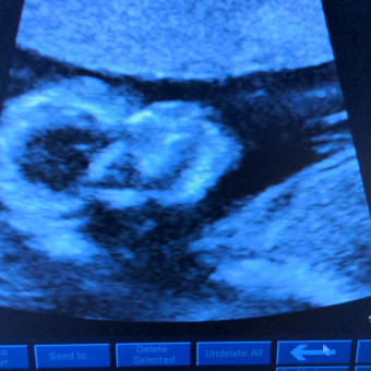Babylist Registry Photo.