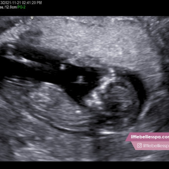 Babylist Registry Photo.