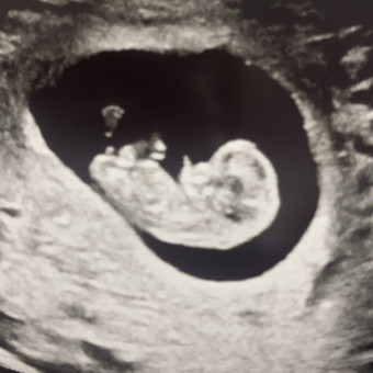 Babylist Registry Photo.