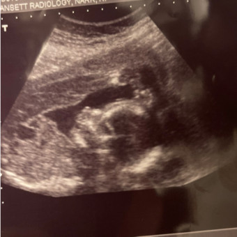 Babylist Registry Photo.
