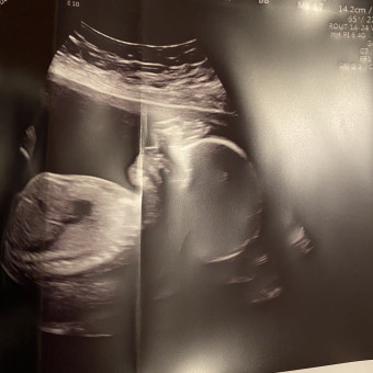 Babylist Registry Photo.