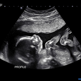 Babylist Registry Photo.