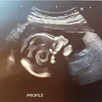 Babylist Registry Photo.