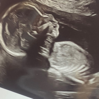 Babylist Registry Photo.