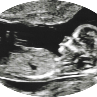 Babylist Registry Photo.