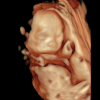 Babylist Registry Photo.
