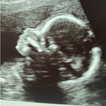 Babylist Registry Photo.