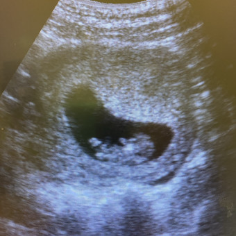 Babylist Registry Photo.